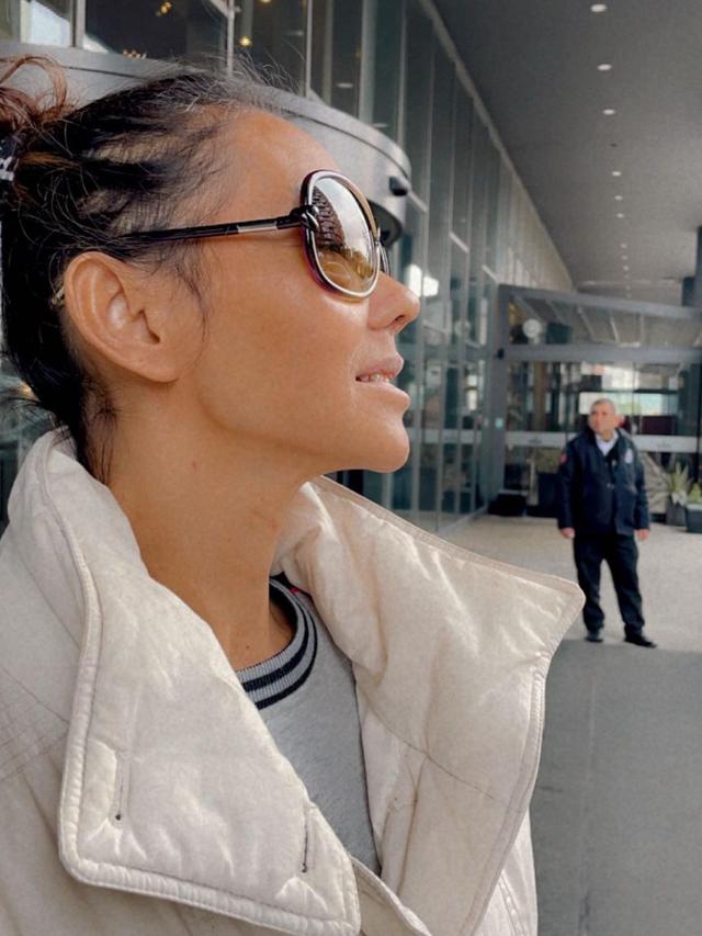 Bunda Corla Operasi Plastik, Ini 6 Potretnya dengan Perban dan Wajah Lebam