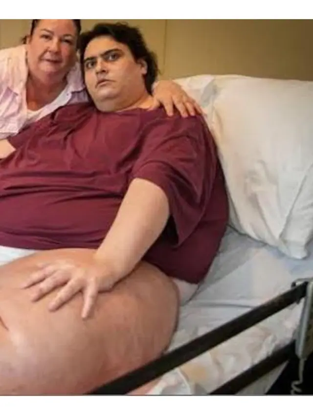 Pria Terberat Berbobot 317 Kilogram Meninggal di Usia 33 Tahun, Ini Penyebabnya