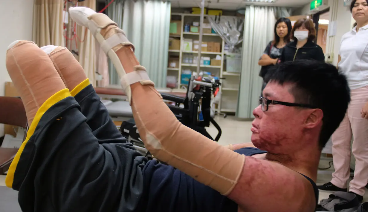 Seorang pria bernama Huang Po - wei saat melakukan sesi rehabilitasi di pusat pemulihan di Taipe, Taiwan, (26/1/2016).  Huang Po - wei korban ledakan disebuah tempat bermain air yang menewaskan 15 orang dan melukai ratusan orang lainnya. (SAM YEH / AFP)