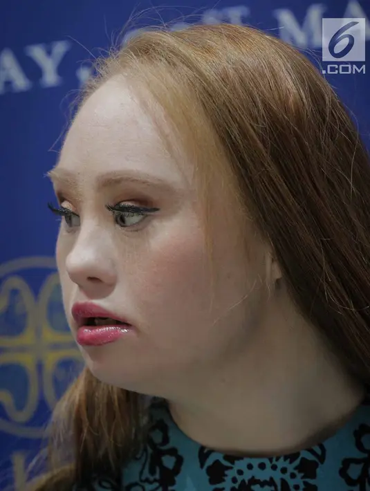 Madeline Stuart berpose usai wawancara dengan Liputan6.com di Alleira Batik Plaza Indonesia, Jakarta, Rabu (20/3). Madeline dianggap sebagai fenomena dunia modelling yang bisa mengubah pandangan dunia mengenai inklusivitas. (Liputan6.com/Faizal Fanani)
