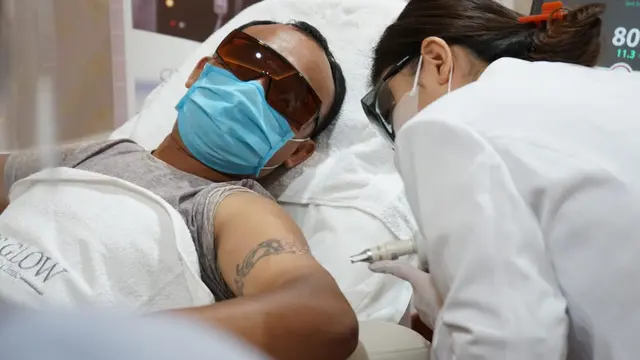 Menghapus tato