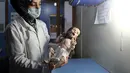 Sahar Dofdaa, bayi Suriah yang menderita kekurangan gizi parah digendong perawat di sebuah klinik pinggiran kota Damaskus, yang dikuasai oposisi, 21 Oktober 2017. Foto bayi malang dengan kondisi menyedihkan itu menjadi sorotan luas. (Amer ALMOHIBANY/AFP)