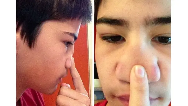 Potret 8 Orang dengan Penampilan Unik Sejak Lahir Ini Bikin Melirik 2 kali