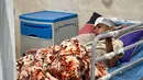 Seorang anak yang terluka—menurut laporan media Iran—akibat serangan yang menghantam sebuah rumah tempat berlangsungnya pesta pernikahan di Kuhestak, Iran selatan, sedang menjalani perawatan di sebuah rumah sakit di Minab, Iran, Rabu dini hari, 2 September 2026. (Morteza Akhoondi/Tasnim News Agency via AP)