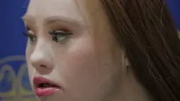 Madeline Stuart berpose usai wawancara dengan Liputan6.com di Alleira Batik Plaza Indonesia, Jakarta, Rabu (20/3). Madeline dianggap sebagai fenomena dunia modelling yang bisa mengubah pandangan dunia mengenai inklusivitas. (Liputan6.com/Faizal Fanani)