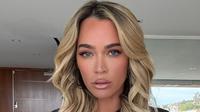 Profil Teddi Mellencamp, Tokoh Televisi Terkenal Amerika yang Terkena Tumor Otak (Instagram/@teddimellencamp/)