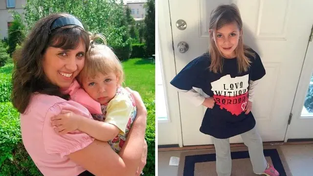 Before - After Adopsi