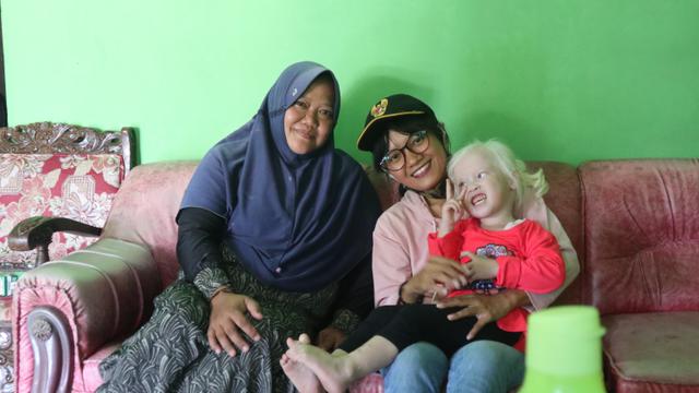 Kembar Albino Wonogiri