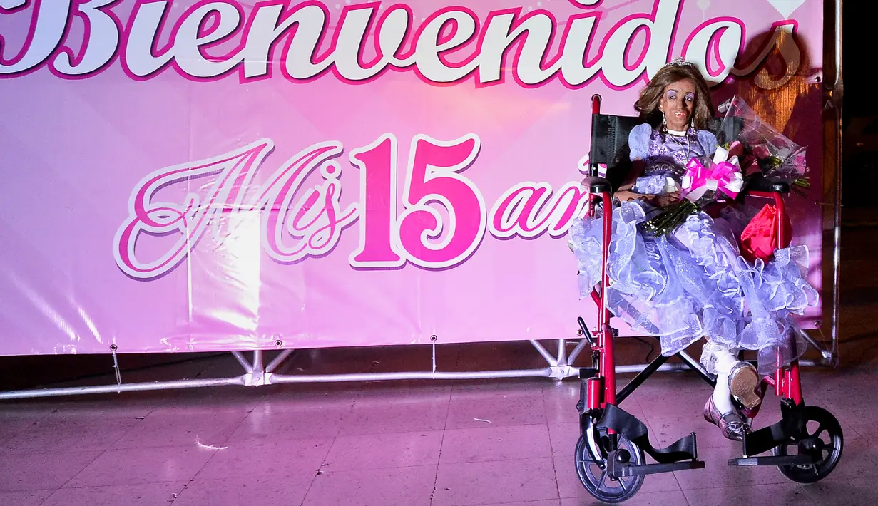 Magali Gonzalez Sierra saat merayakan ulang tahunnya ke-15 di El Cabuyal, Kolombia, 16 Januari 2016. Magali menderita progeria, kelainan genetik yang membuat tubuhnya cepat tua sehingga memiliki tubuh setara wanita berusia 90 tahun. (AFP/LUIS ROBAYO)