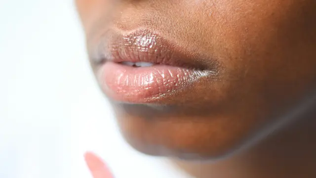 Pahami Penyebab Bibir Gelap yang Perlu Diketahui