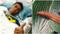 Mabuk dan Nekat Telan Bekicot Hidup, Pemuda Ini Alami Kelumpuhan Selamanya