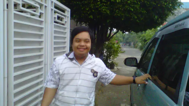 Down Syndrome