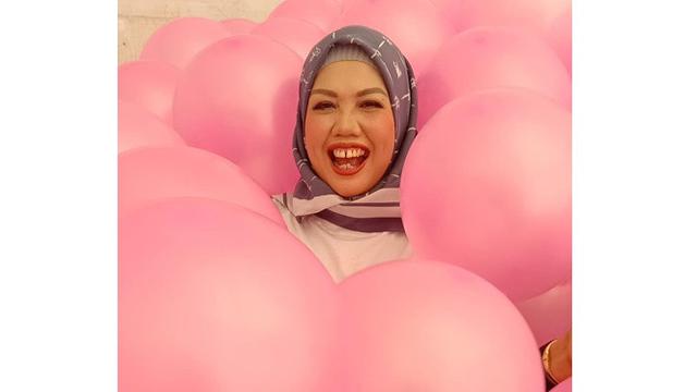 Lakukan Tanam Benang di Wajah, Ini 6 Potret Ely Sugigi Tampil Glowing