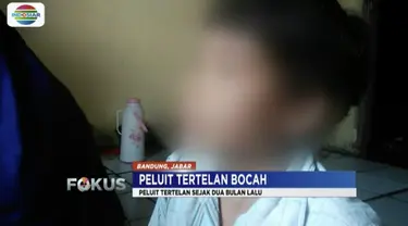 Kondisi Asep Yaya, bocah sekolah dasar yang tertelan peluit, sudah stabil dan bisa pulang dari RS Hasan Sadikin.