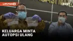 Permintaan Autopsi Ulang Jasad Brigadir J akan dilakukan Polisi