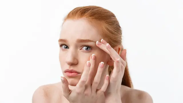 Kulit Mengelupas dan Menjadi Tipis