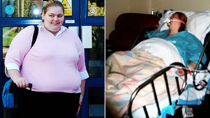 Beth sebelum operasi | Foto: Dailymail.co.uk