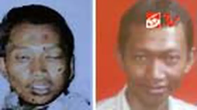 Keterkaitan Bom Cirebon dan Solo Masih Diinvestigasi