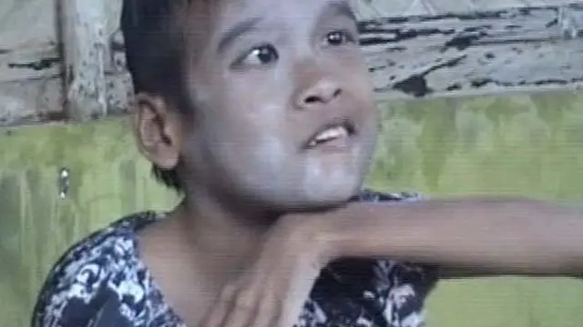 Herlina, Belasan Tahun Lumpuh Layu