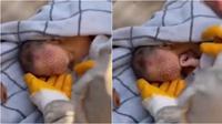 Kisah pilu bayi 20 hari selamat dari gempa Turki, genggam segumpal rambut ibunya. (Sumber: Twitter/TansuYegen)