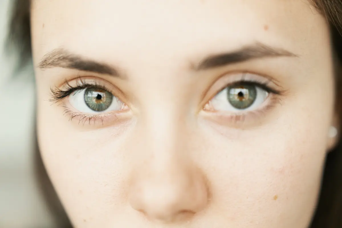Harus Tahu, Ini Perbedaan Dark Circle, Eye Bags, dan Puffy Eyes