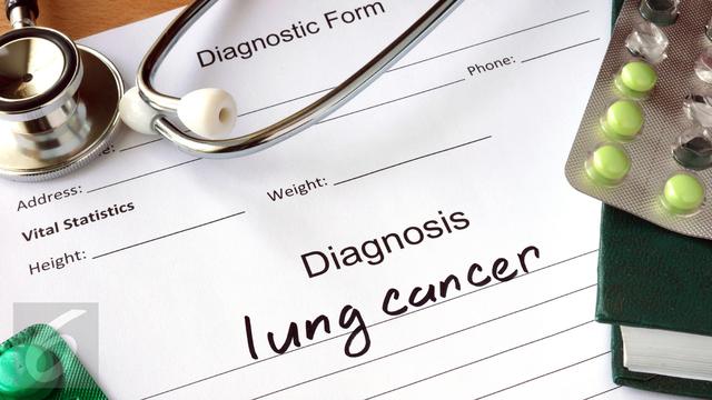 20160205-Kanker Paru Paru-iStockphoto