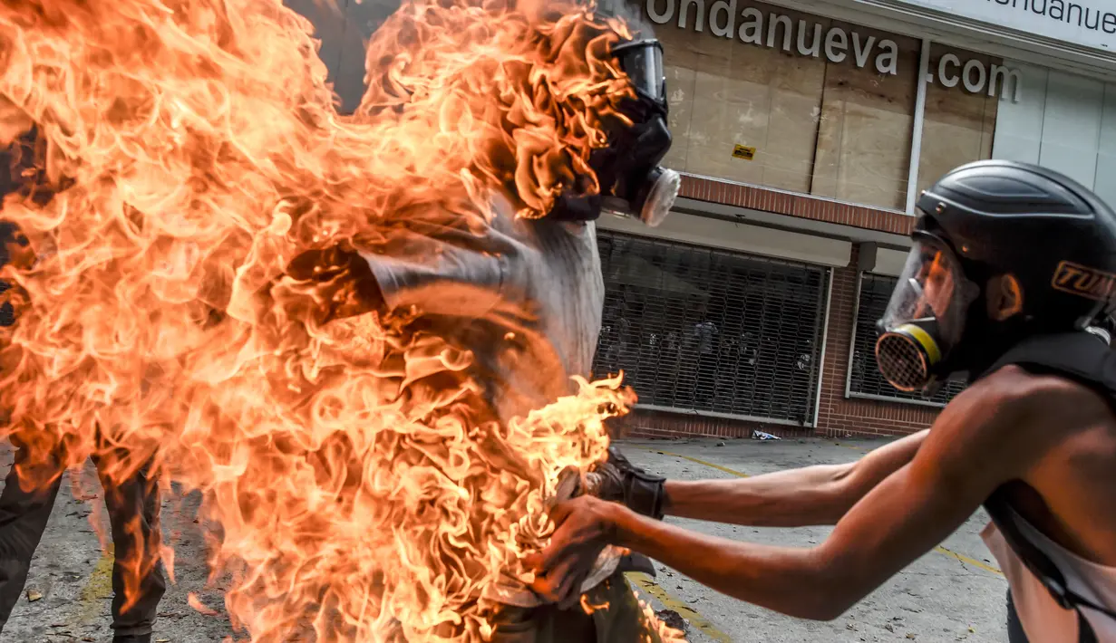 Demonstran melepaskan pakaian rekannya yang terbakar saat unjuk rasa yang diwarnai bentrokan menentang Presiden Venezuela, Nicolas Maduro di Caracas, Rabu (3/5). Pria itu tersulut api dari ledakan tangki motor milik polisi. (RONALDO SCHEMIDT / AFP)