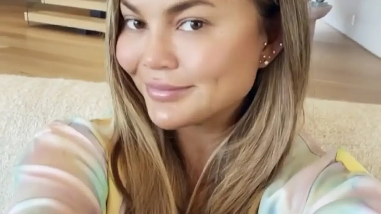 Mengenal Buccal Fat Removal yang dilakukan juga oleh Chrissy Teigen