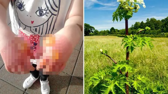 [Bintang] Ternyata Ini Alasan Mengapa Tanaman Hogweed Berbahaya Bagi Manusia