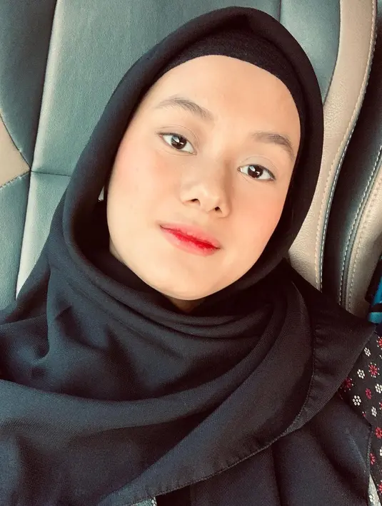 Belakangan bentuk hidung Dinda Hauw disebut hasil operasi plastik. Siapa sangka, ia tak pernah melakukan teknik kecantikan itu. (Liputan6.com/IG/@dindahw).