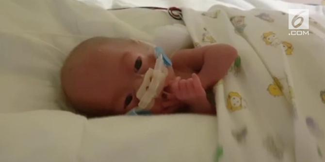 VIDEO: Bayi Berbobot 302 Gram Mampu Bertahan Hidup