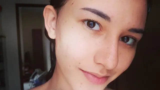 Wajahnya Dicibir Banyak Komedo, Ini 6 Potret Dahlia Poland Tanpa Makeup