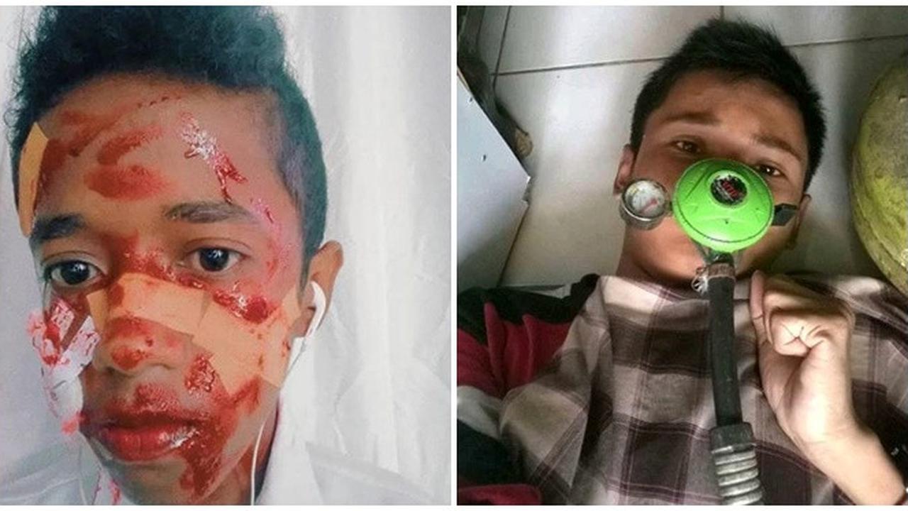 Potret Nyeleneh Pura-Pura Sakit Ini Bikin Ketawa Sekaligus Emosi