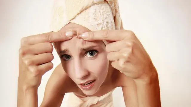 Tips hilangkan jerawat