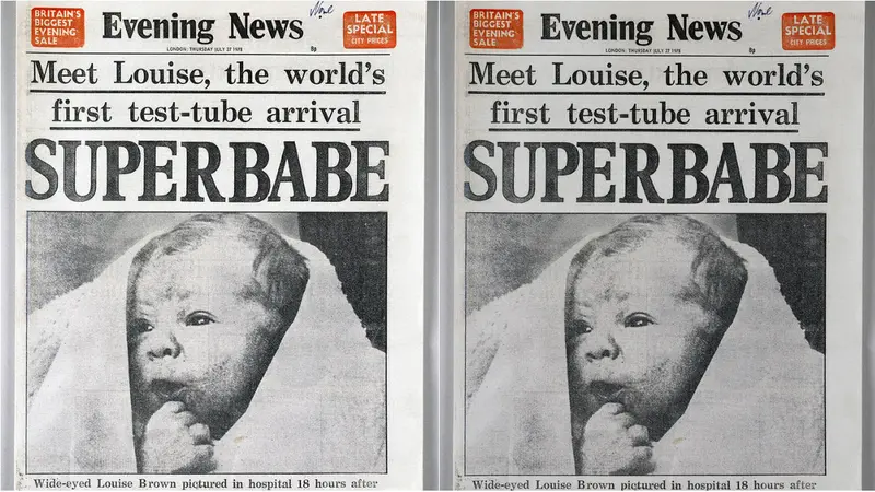 25-7-1978: Lahirnya Bayi Tabung Pertama di Dunia