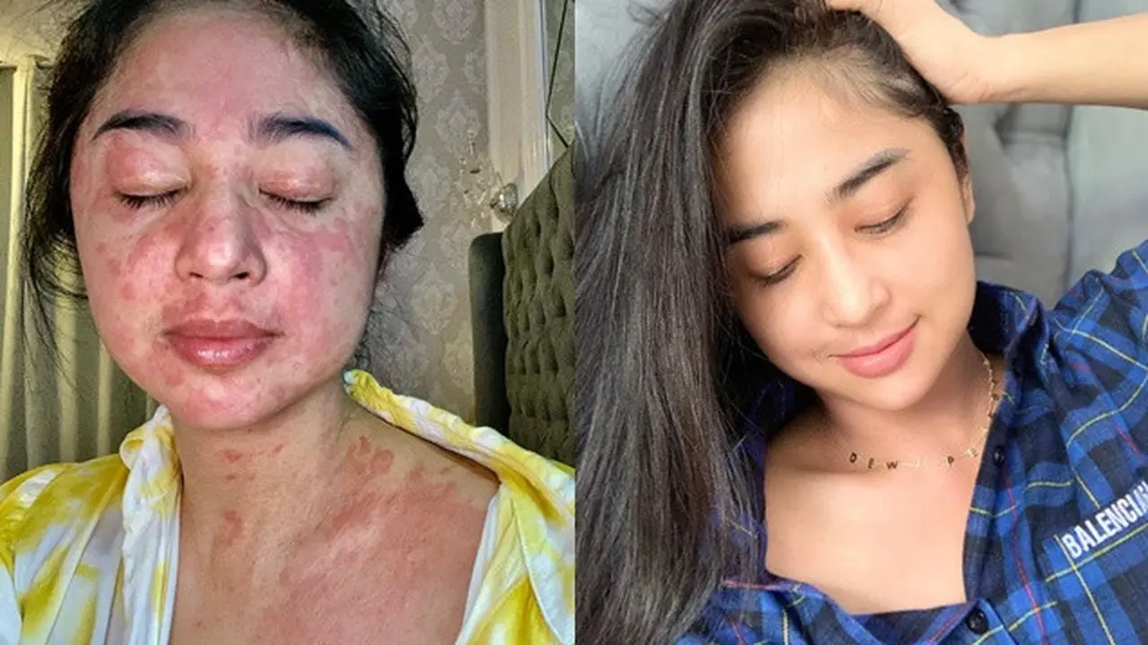 5 Potret Terbaru Dewi Perssik Sembuh dari Covid-19, Sudah Kembali Syuting