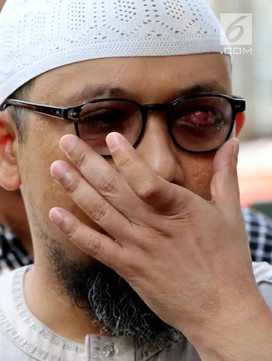 Penyidik KPK Novel Baswedan usai memberi keterangan pers di sela silaturahmi dengan WP KPK di kediamannya di Kelapa Gading, Jakarta, Minggu (17/6). Silaturahmi digelar dalam rangka Idul Fitri. (Liputan6.com/JohanTallo)