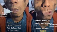 Viral, Tingkah Absurd Pria Kasih Lem di Bibir Ini Bikin Eskpresinya Kocak
