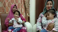 Bayi kembar siam Kendari, Aqila Dewi Sabila dan Azila Dewi Sabrina, setelah berhasil dipisahkan tim dokter RS Dr Soetomo Surabaya.(Liputan6.com/Ahmad Akbar Fua)