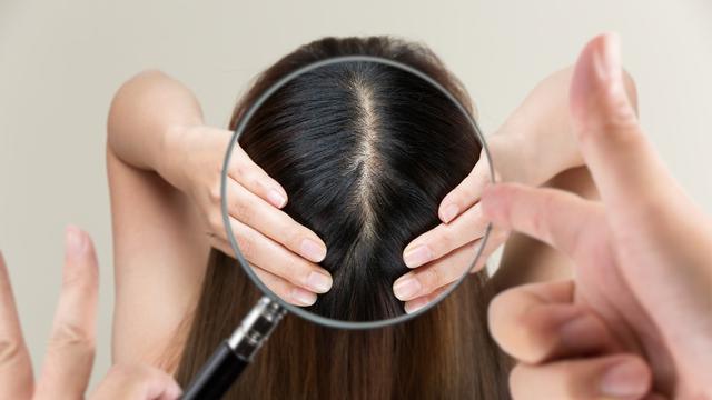 12 Penyebab Kulit Kepala Bau Apek yang Jarang Disadari, Cek Cara Mengatasinya!