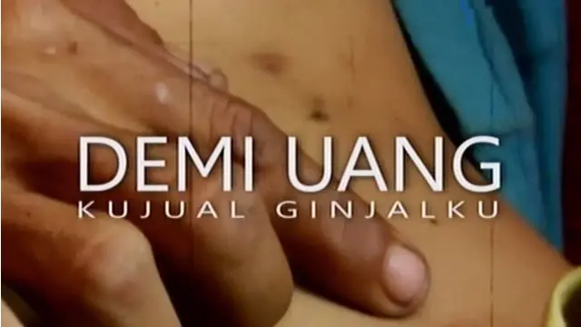 Segmen 2: Polisi Dalami Sindikat Jual Beli Ginjal