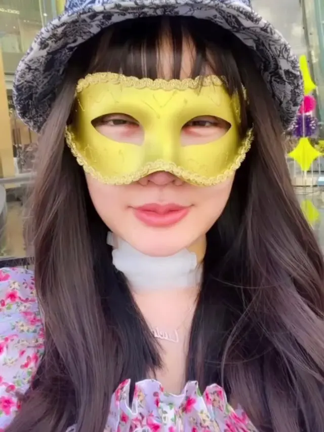 6 Potret Lucinta Luna Lepas Perban Pasca Oplas, Bibirnya Disebut Mirip Jisoo BLACKPINK
