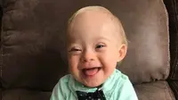 Lucas Warren, bayi down syndrome memenangi kontes "Baby Gerber 2018." (Gerber/Cortney Warren)