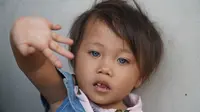 Amelia Anggraeni (2,5) memiliki wafna bola mata yang berubah-ubah. (Liputan6.com/Huyogo Simbolon)