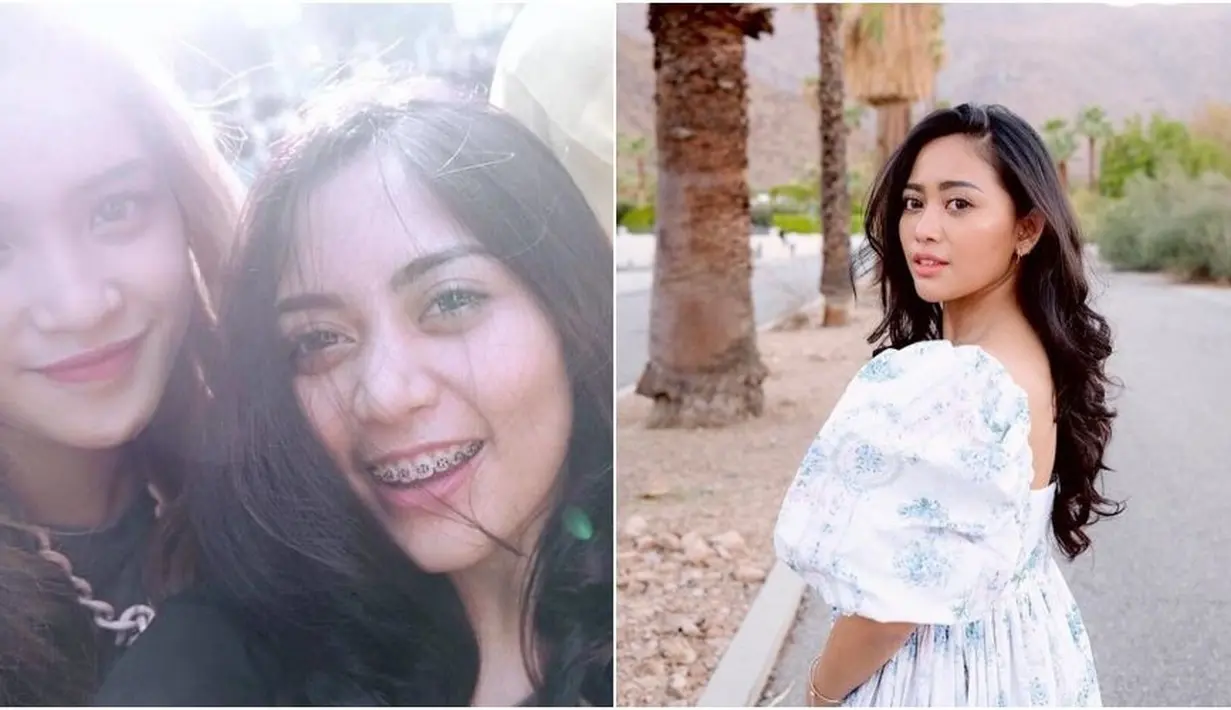 Tahun 2014 Rachel Vennya sempat memasang behel gigi, yang saat itu jadi tren di kalangan anak muda. (brilio/Instagram @rachelvennya)