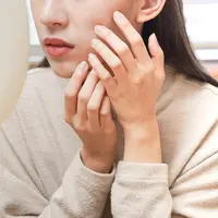 Ilustrasi wajah bruntusan. (c) Shutterstock/Kmpzzz