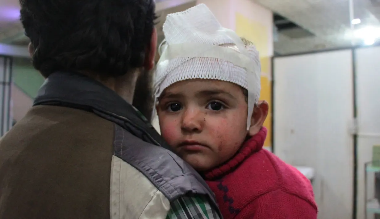 Ekspresi seorang anak yang terluka akibat serangan udara pasukan Assad di wilayah Ghouta timur, Suriah (7/2). (AFP Photo/Hamza Al-Ajweh)