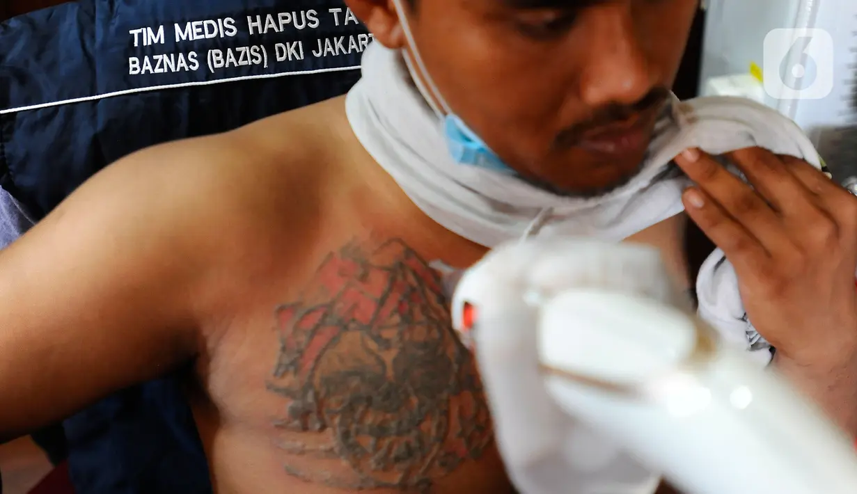 Warga saat mengikuti kegiataan hapus tato gratis saat pelaksanaan Festival Budaya Setu Babakan di Setu babakan, jakarta selatan, Minggu (14/08/20222). Lebih dari seratus warga dihapus tatonya dalam kegiatan yang diselenggarakan oleh IMS (Islamic Medical Service), KADIN Jaksel dan Baznas (Bazis) ini. (merdeka.com/Arie Basuki)