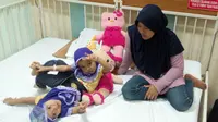 RSHS berhasil mengoperasi pengangkatan kaki tambahan anak kembar siam, Al Putri Anugrah dan Al Putri Dewiningsih, Selasa 26 September 2017. (Liputan6.com/Huyogo Simbolon)