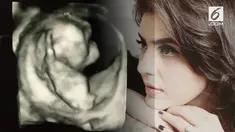 Carissa Puteri mengunggah foto hasil USG kandungannya yang kedua di Instagram.